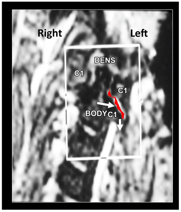 Figure 19