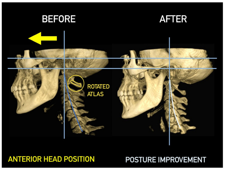 Figure 28