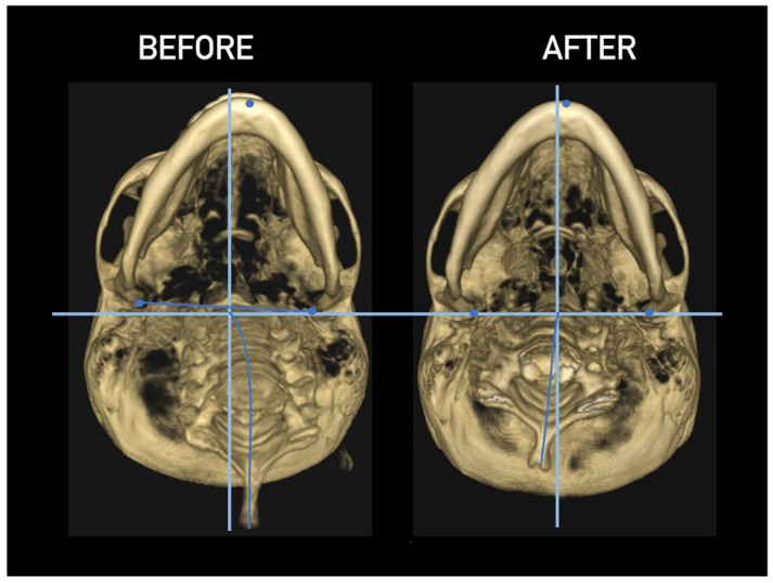 Figure 27