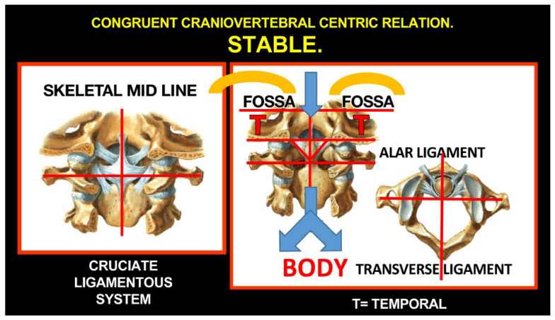 Figure 30