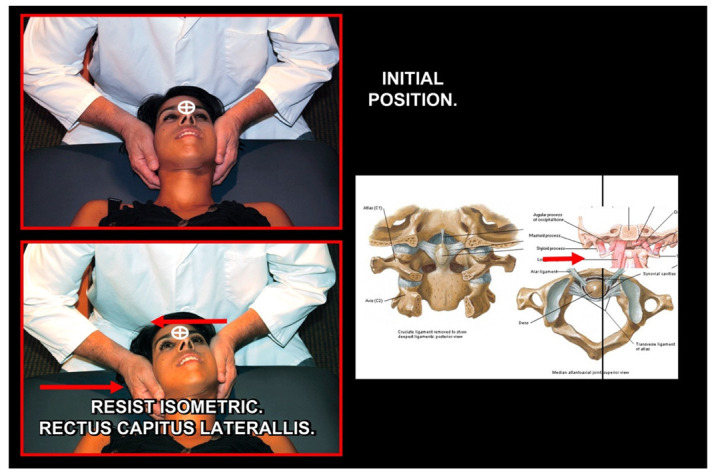 Figure 22