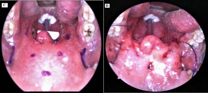 Fig. 2