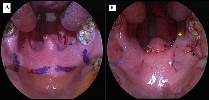 Fig. 1