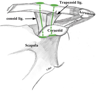 Fig. 1