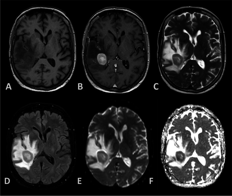 Fig. 1