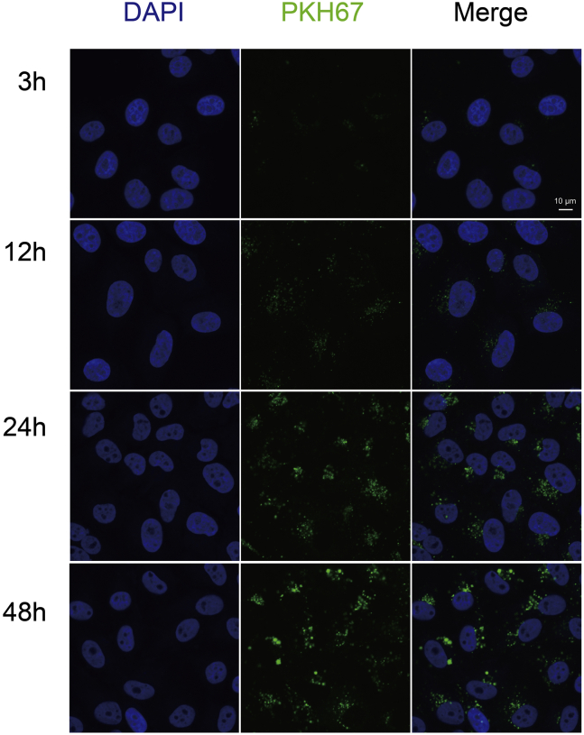 Fig. 12