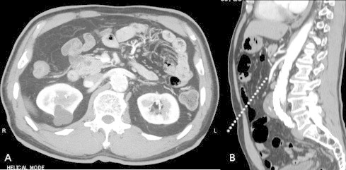 Fig. 1