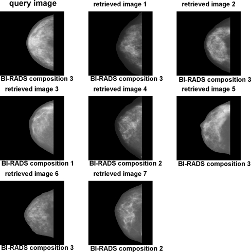 Fig 14