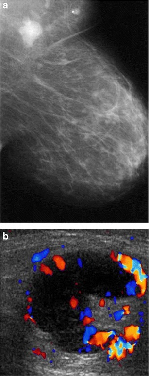 Fig. 11