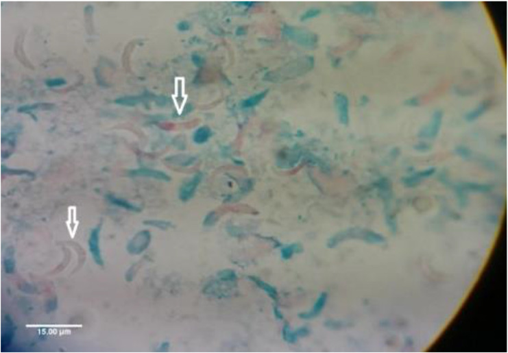 Fig. 1: