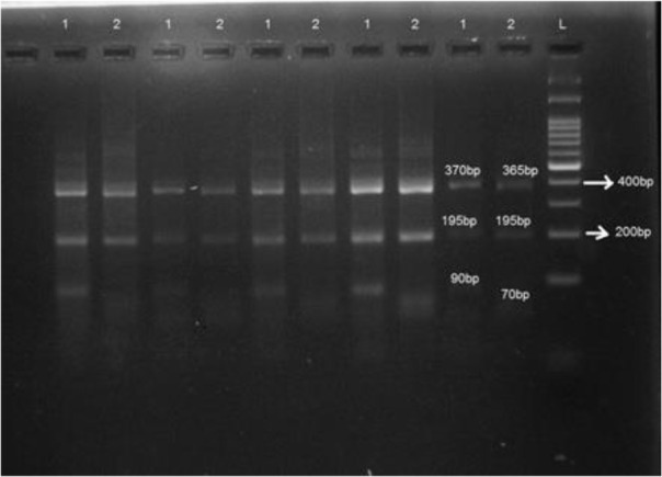 Fig. 3 :