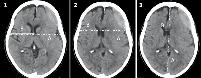 Fig. 2