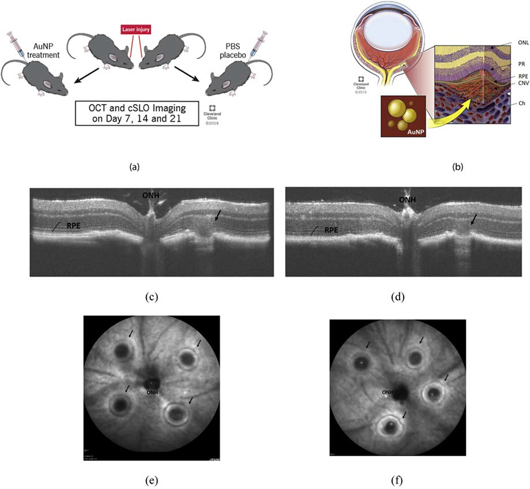 Figure 1: