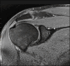 Figure 2b