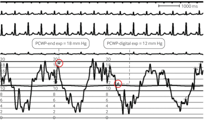 Fig 4