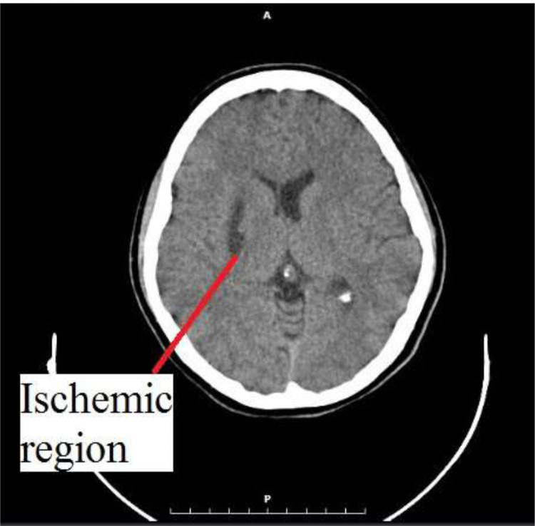 Fig 1