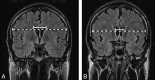 Fig 1.
