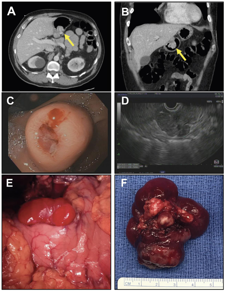 Figure 1: