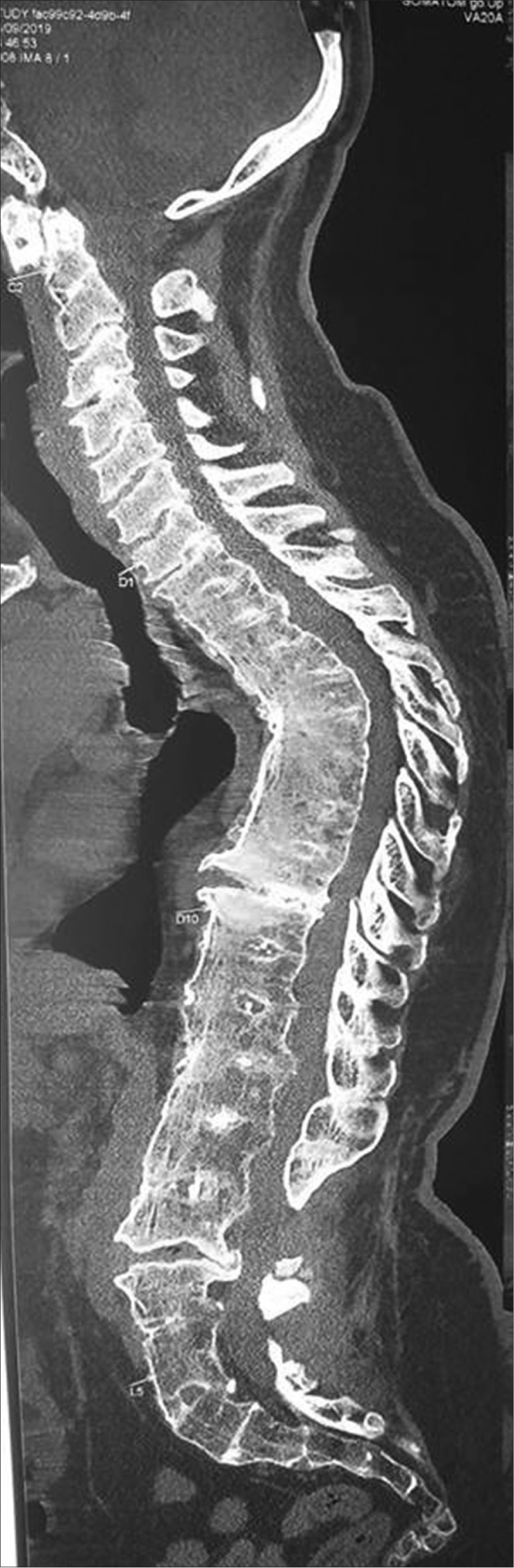 Figure 2: