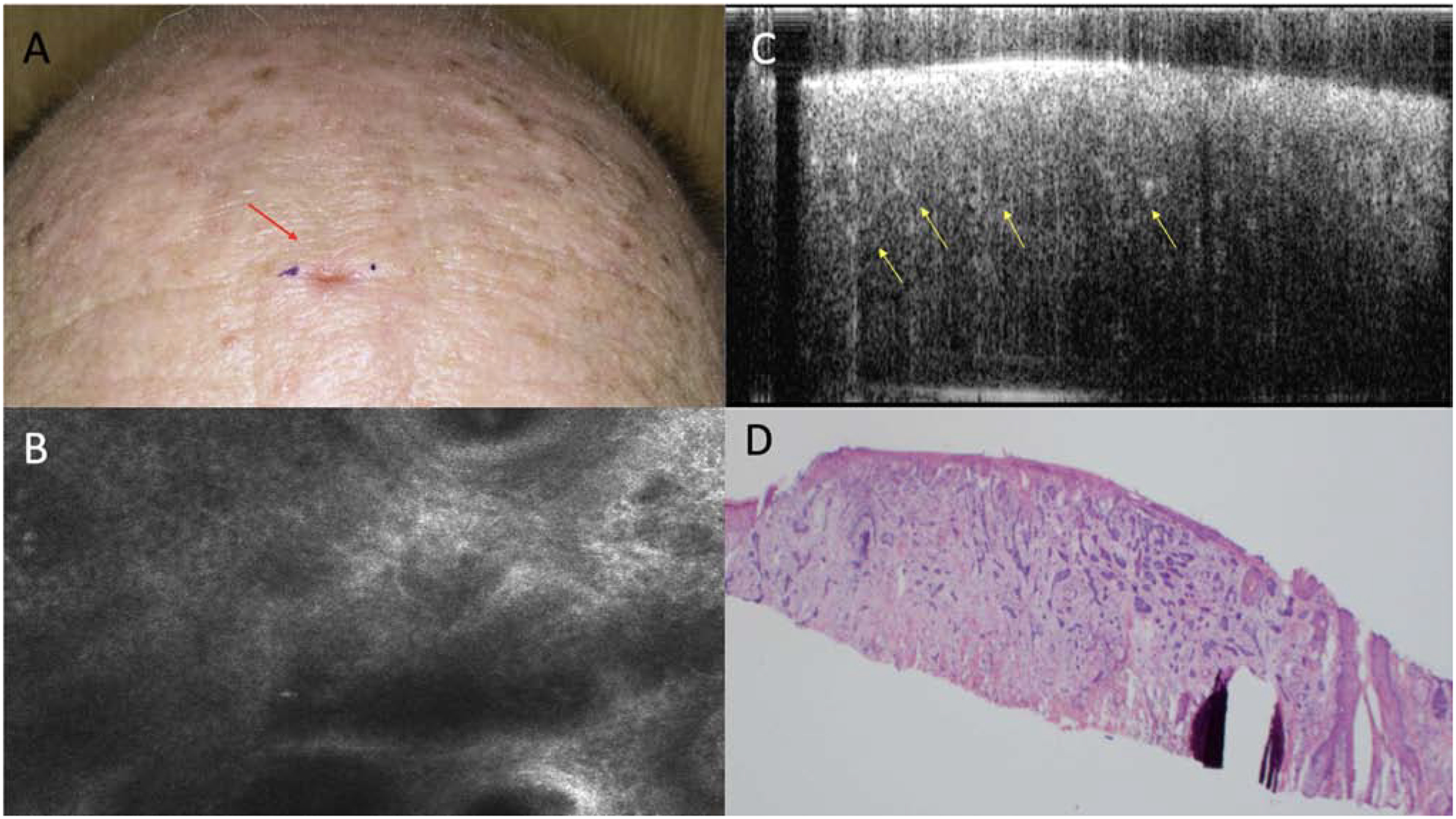 Figure 4: