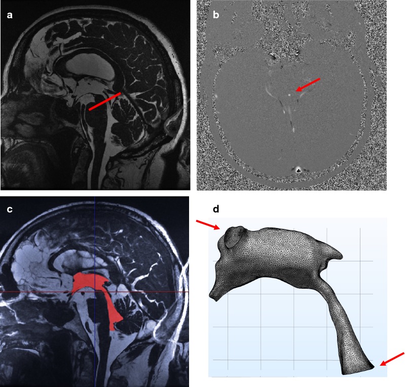 Fig. 2