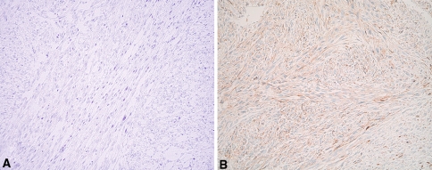 Fig. 3A–B