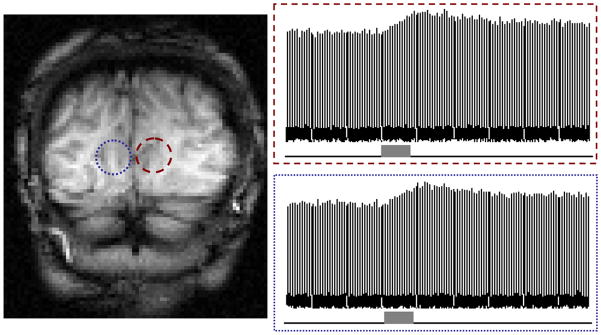 Fig. 11