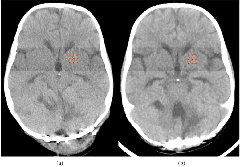 Fig. 5