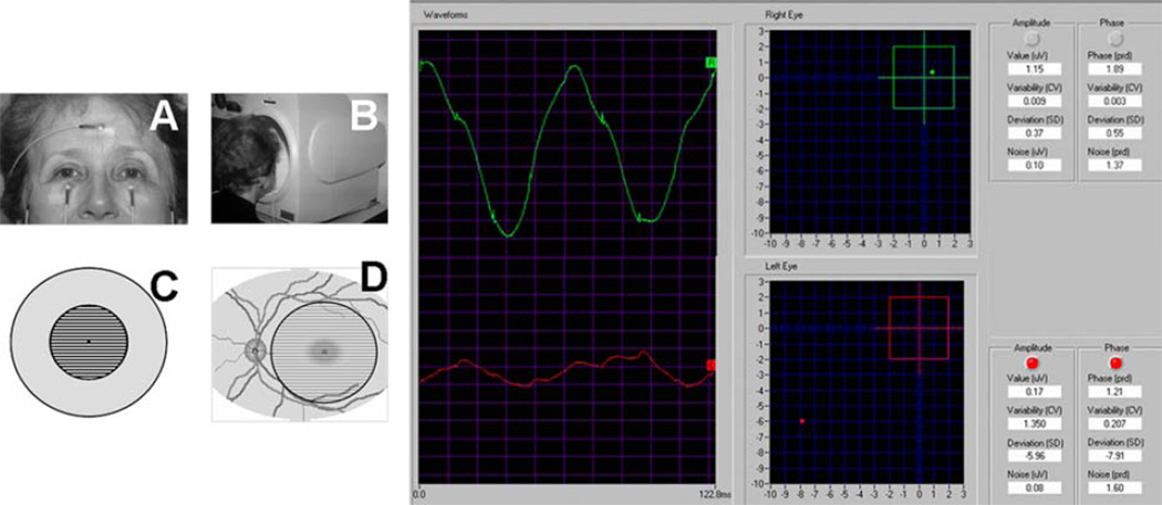 Fig. 1