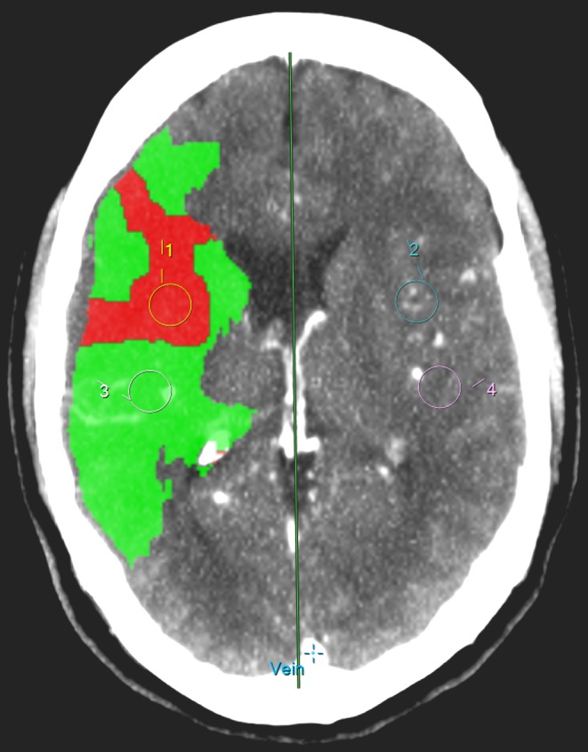 Fig. 1