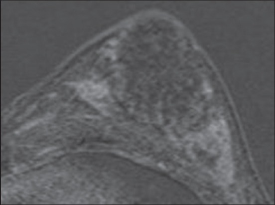 Fig. 18