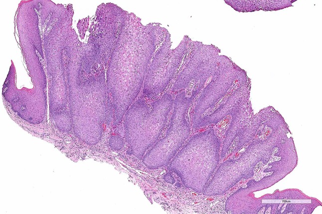 Fig. 2
