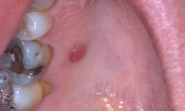 Fig. 1
