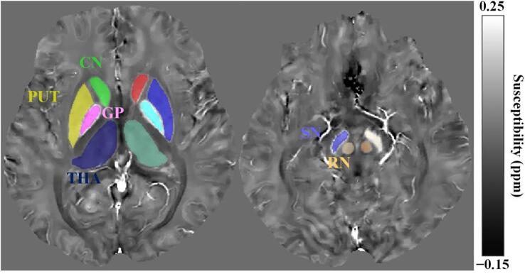Fig. 2