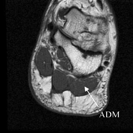 Fig. 1