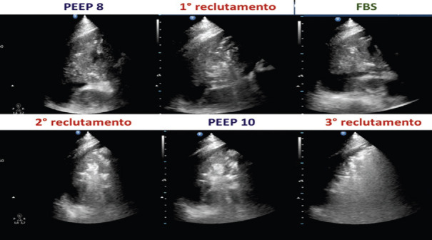 Figure 17