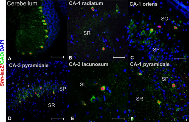 Figure 13