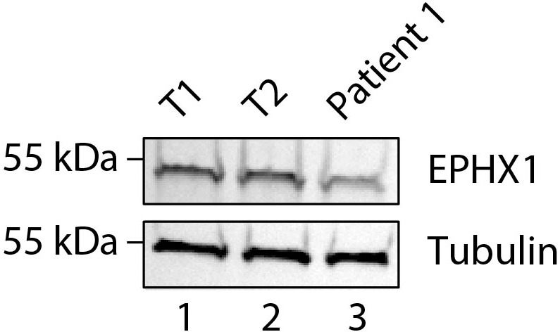 Figure 6—figure supplement 1.