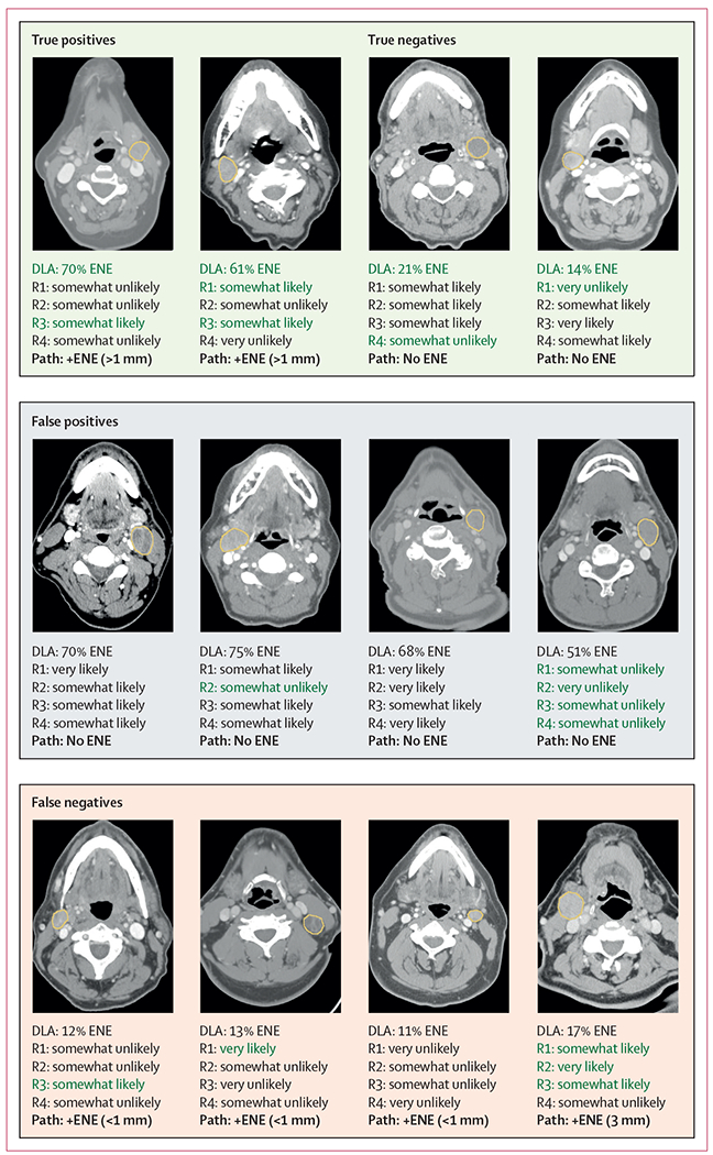 Figure 4: