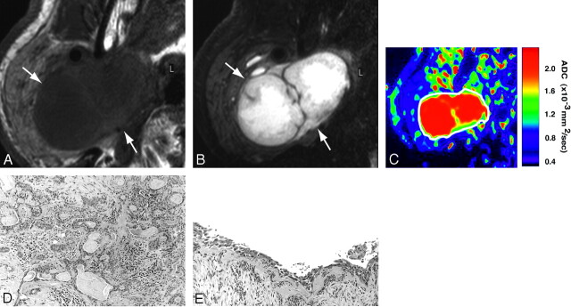 Fig 2.