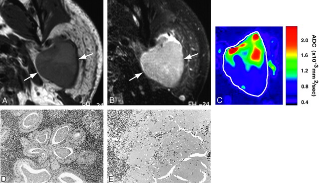 Fig 3.