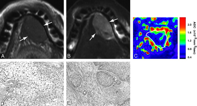 Fig 4.