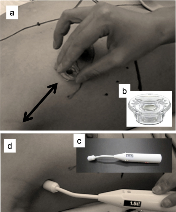 Fig. 1