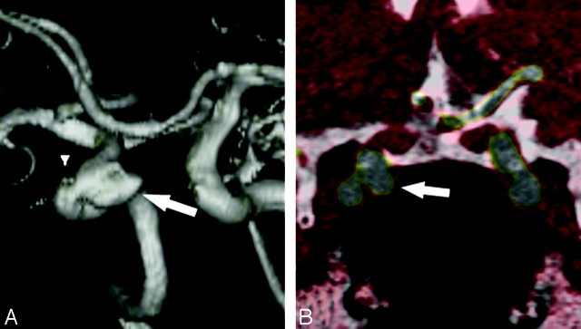 Fig 3.