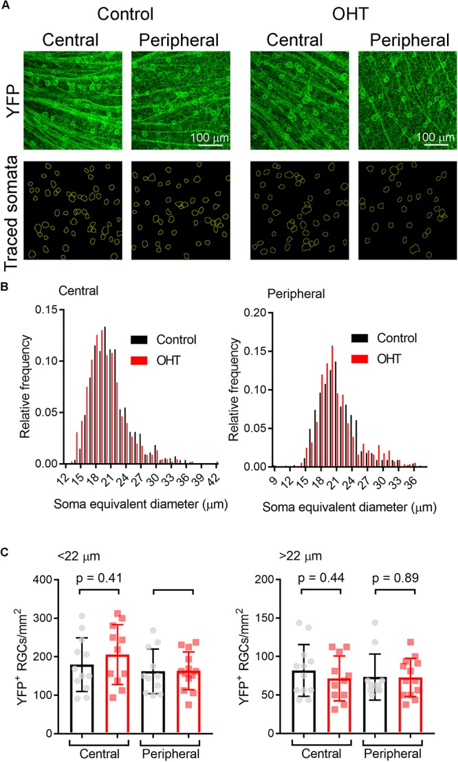 FIGURE 11