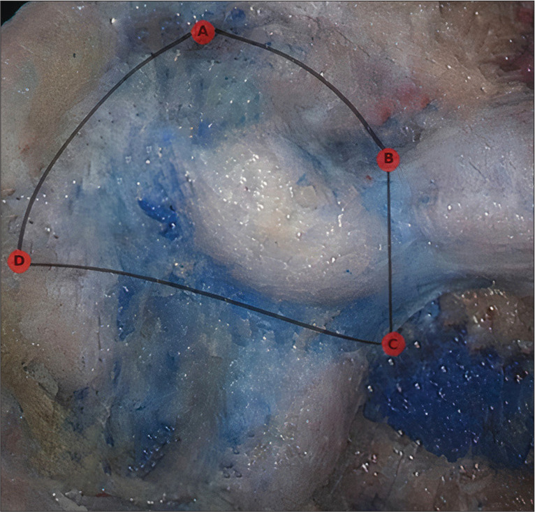 Figure 3: