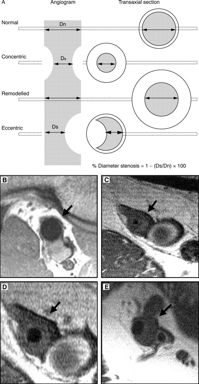 Figure 1  