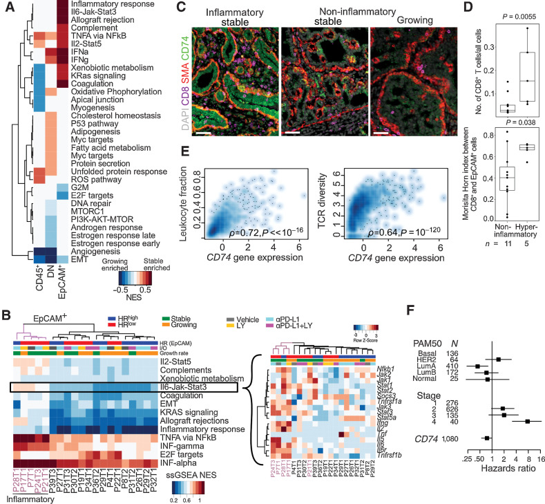 Figure 5. Molecular profiles of inflammatory tumor epithelial cells from immunotherapy-treated cohort of NMU-induced tumors. A, GSEA between growing versus stable tumors in CD45+, DN (double negative), and EpCAM+ cells using the MSigDB Hallmark compendium. Red and blue indicates stable and growing enriched, respectively, FDR < 0.05. B, Normalized single-sample gene set enrichment scores (ssGSEA NES) of significant pathways in EpCAM+ cells of each tumor. Inset, gene expression row z-scores of genes in the IL6–JAK–STAT3 signaling pathway. Hyperinflammatory tumors indicated in purple C, Immunofluorescence analysis of inflammatory and noninflammatory tumors for CD8, SMA, and CD74. Scale bar, 50  μm. D, Comparison of CD8+ T-cell frequency and intermixing with EpCAM+ cells in hyperinflammatory and noninflammatory tumors in WSI. Quartiles and range are shown. P values were calculated using Wilcoxon rank-sum test. E, Spearman correlation of CD74 expression with leukocyte infiltration and TCR diversity in TCGA breast cancer cohort (N = 1,054 complete observations). F, Forest plot showing HRs with 95% CIs from multivariable Cox regression analysis using CD74 gene expression z-score, PAM50 subtype and tumor stage in TCGA breast cancer cases. Log-rank test P value: 3 × 10−9. All tests for significance used Mann–Whitney–Wilcoxon test using a threshold of P = 0.05 unless otherwise specified; error bars representative of SD; box-whisker plots indicate 0th, 25th, 50th, 75th, and 100th percentiles.