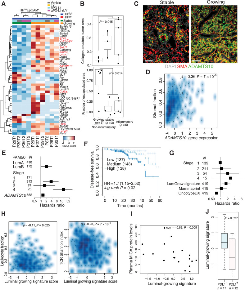 Figure 6. Molecular profiles of HRhigh tumor epithelial cells. A, Heatmap of row-normalized Z-scores of DEGs between HRhigh growing and stable tumors in the EpCAM+ fraction. B, Trichrome staining quantification comparing inflammatory with noninflammatory growing and noninflammatory stable tumors. Quartiles and range are shown. P values were calculated using Wilcoxon rank-sum test between growing and all other tumors. C, Immunofluorescence analysis of HRhigh tumors for SMA and ADAMTS10. Scale bar, 50 μm. D, Spearman correlation of ADAMTS10 expression with inferred stromal content in TCGA luminal breast cancer cases (N = 564 complete observations). E, Forest plot showing HRs with 95% CIs from multivariable Cox regression analysis using ADAMTS10 gene expression z-score, PAM50 subtype and tumor stage in TCGA luminal breast cancer cases HR = 1.37 (0.97–1.95), log-rank P value = 1 × 10−6. F, Kaplan–Meier plot of DFS of patients with TCGA Lum A breast cancer segregated by “Luminal-growing” signature expression. Dark, medium, and light blue curves represent terciles with high, medium, and low expression of the signature, respectively. HR, 95% CI, and log-rank P value from a Cox model using the signature score as a continuous variable and accounting for stage are shown. G, Forest plot of showing HR and 95% CIs modeling contributions of the luminal-growing signature, OncotypeDx, and Mammaprint to DFS in a Cox proportional hazards regression accounting for tumor stage in TCGA Lum A breast cancers. HR = 1.78 (1.16–2.72), log-rank P = 0.03. H, Spearman correlation of “Luminal-growing” gene signature with leukocyte infiltration and TCR diversity in TCGA Luminal breast cancer cases (N = 553 complete observations) I, Spearman correlation between Luminal-growing signature score and plasma MICA protein levels in ER+ metastatic breast cancer cohort (N = 19). J, Boxplot of luminal-growing signature score in PD-L1–positive and PD-L1–negative metastatic breast cancer samples. All tests for significance used Mann–Whitney–Wilcoxon test using a threshold of P = 0.05 unless otherwise specified; error bars representative of SD; box-whisker plots indicate 0th, 25th, 50th, 75th, and 100th percentiles.