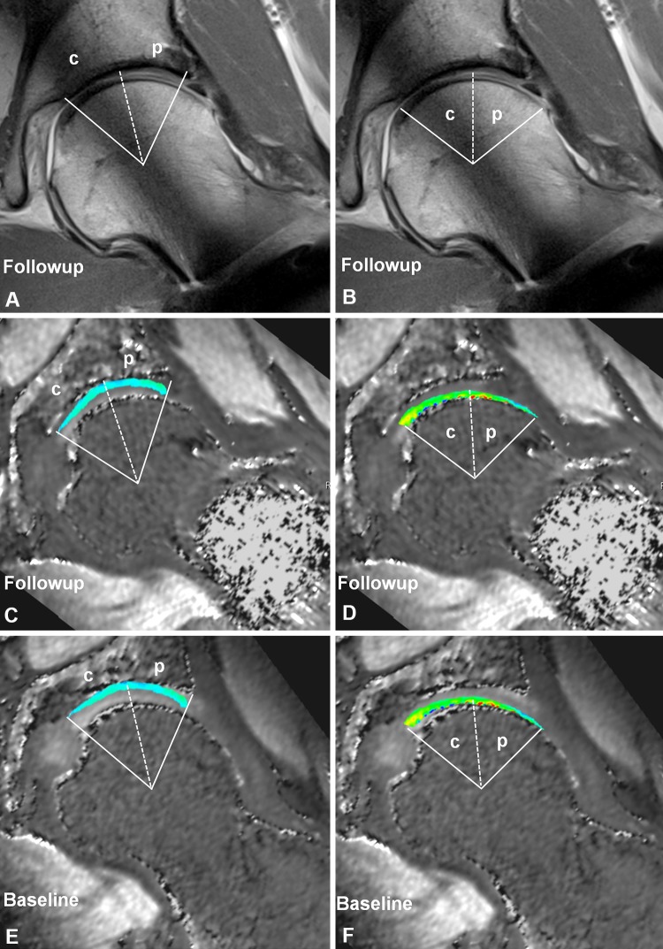 Fig. 4A–F